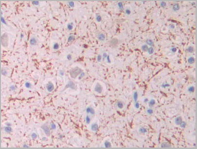 product-image-AAA21212_IHC2.jpg