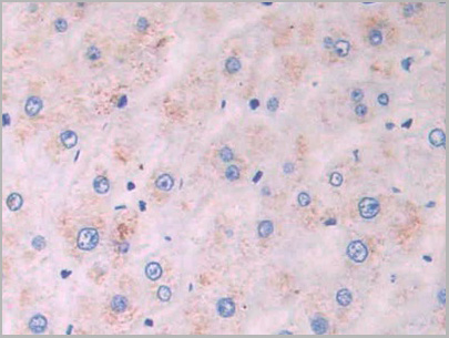 product-image-AAA21212_IHC6.jpg