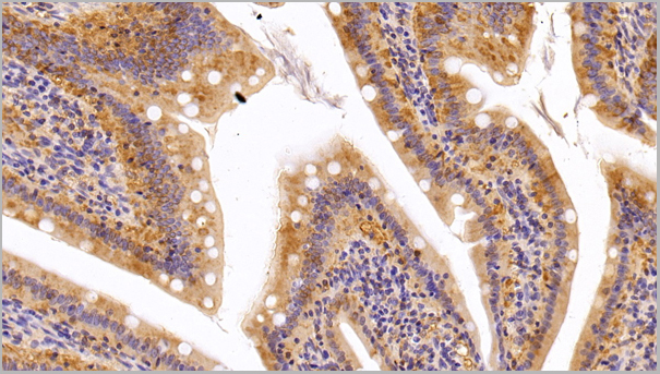 product-image-AAA21213_IHC.jpg