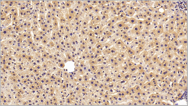 product-image-AAA21213_IHC2.jpg