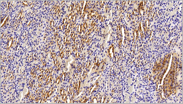 product-image-AAA21213_IHC3.jpg