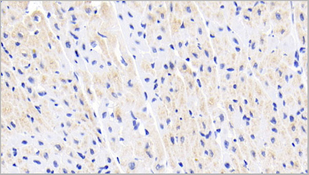 product-image-AAA21215_IHC.jpg