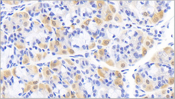 product-image-AAA21215_IHC2.jpg