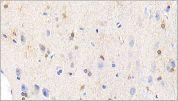 product-image-AAA21215_IHC3.jpg