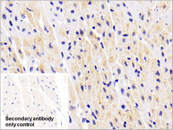 product-image-AAA21215_IHC5.jpg
