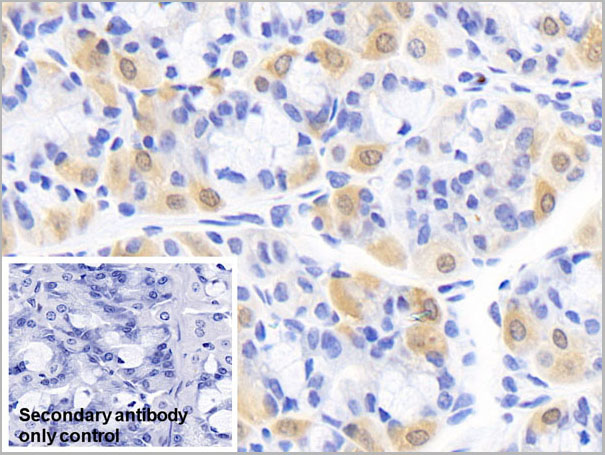 product-image-AAA21215_IHC6.jpg