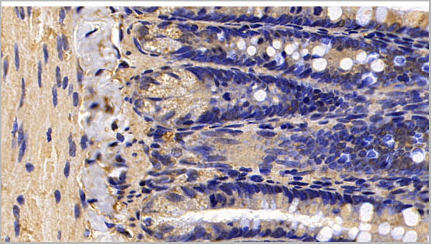 product-image-AAA21216_IHC.jpg