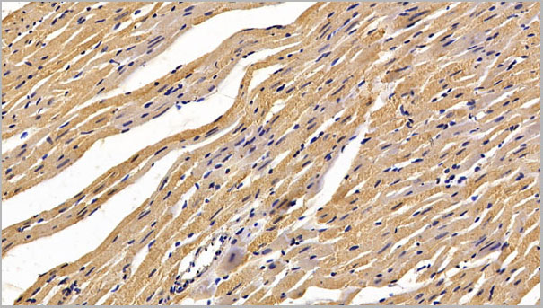 product-image-AAA21216_IHC3.jpg