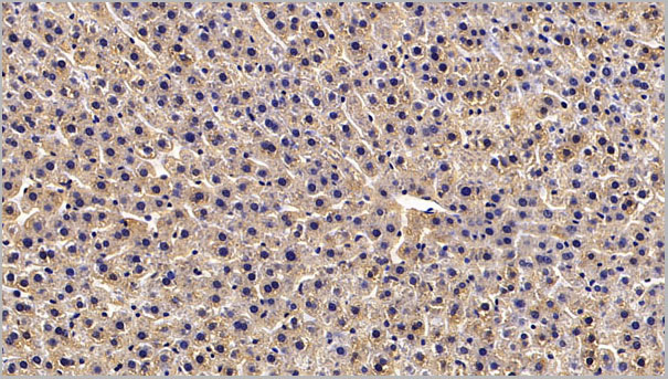product-image-AAA21216_IHC5.jpg