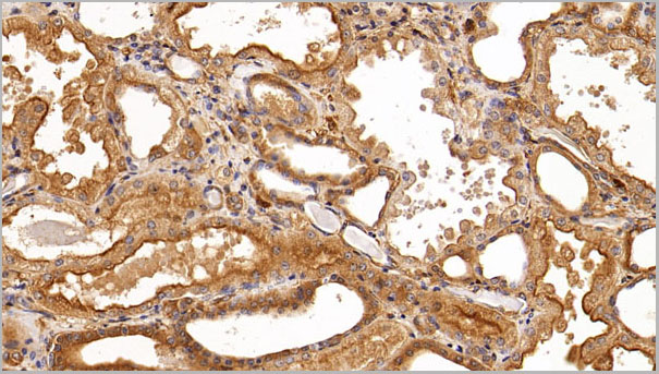 product-image-AAA21217_IHC.jpg
