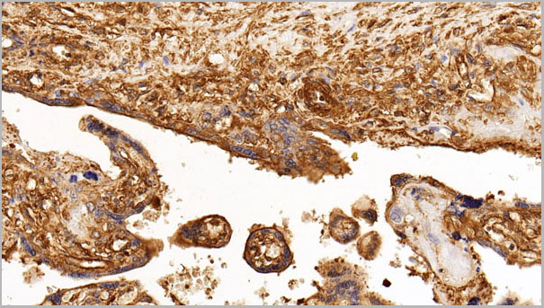 product-image-AAA21217_IHC2.jpg