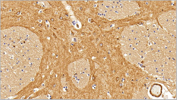 product-image-AAA21217_IHC3.jpg
