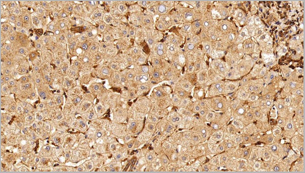 product-image-AAA21217_IHC4.jpg