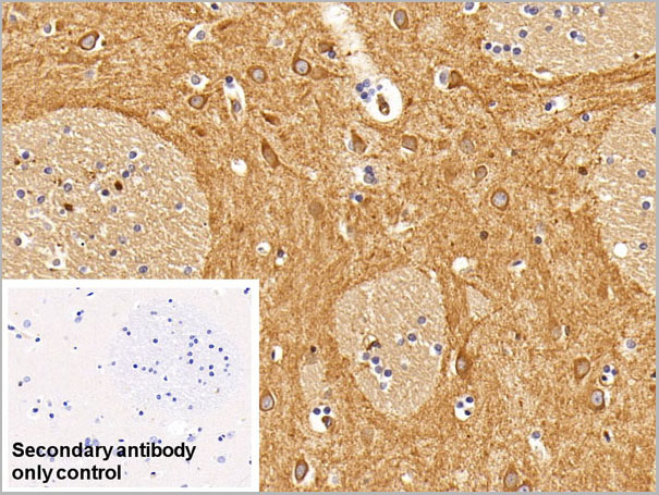 product-image-AAA21217_IHC5.jpg