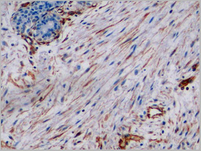 product-image-AAA21218_IHC.jpg