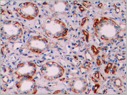 product-image-AAA21218_IHC2.jpg