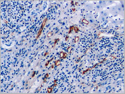product-image-AAA21218_IHC3.jpg