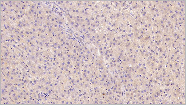 product-image-AAA21221_IHC2.jpg