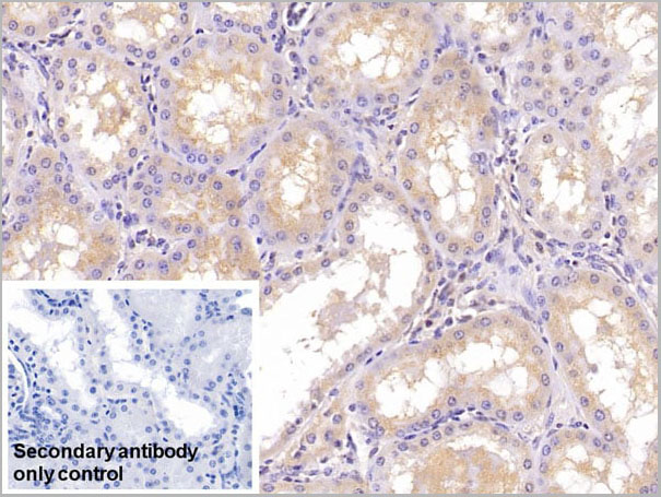 product-image-AAA21221_IHC4.jpg