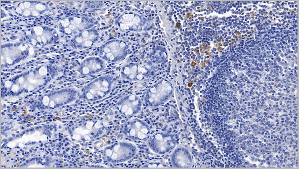 product-image-AAA21222_IHC.jpg