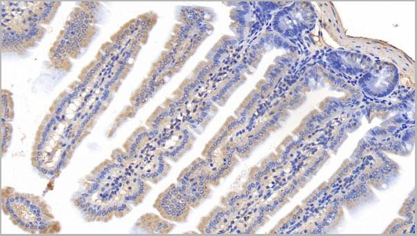 product-image-AAA21223_IHC2.jpg