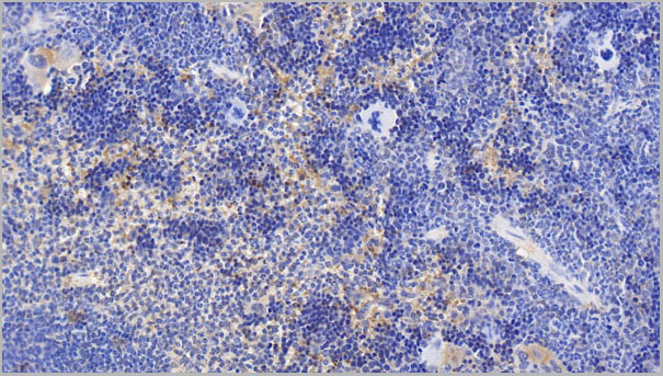 product-image-AAA21223_IHC3.jpg