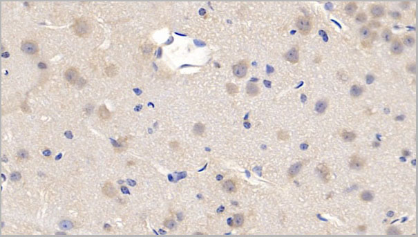 product-image-AAA21223_IHC4.jpg
