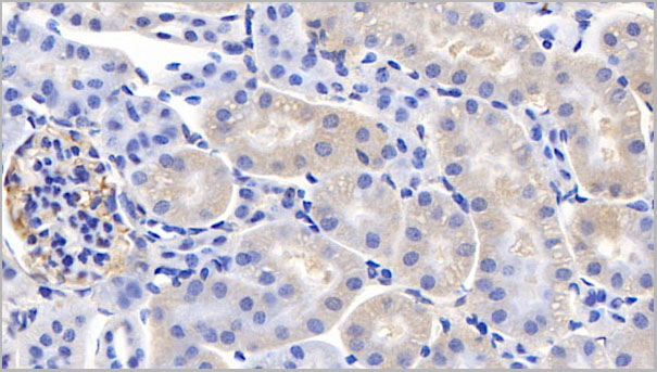 product-image-AAA21223_IHC5.jpg