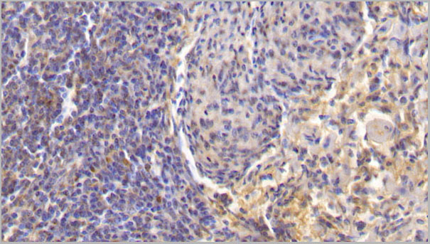 product-image-AAA21224_IHC.jpg
