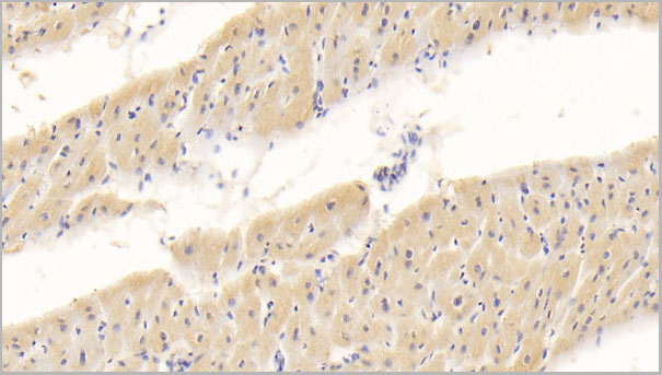 product-image-AAA21224_IHC2.jpg