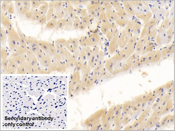 product-image-AAA21224_IHC4.jpg