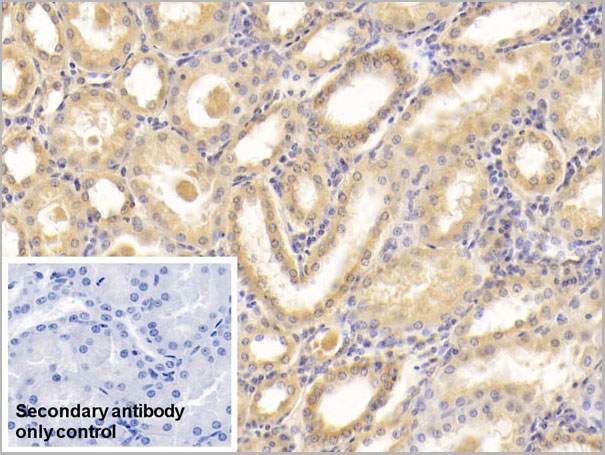 product-image-AAA21224_IHC5.jpg