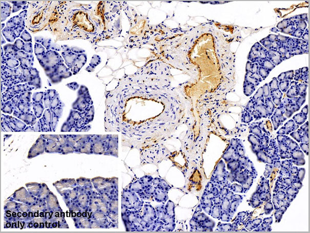 product-image-AAA21225_IHC6.jpg