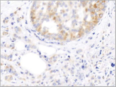 product-image-AAA21226_IHC3.jpg