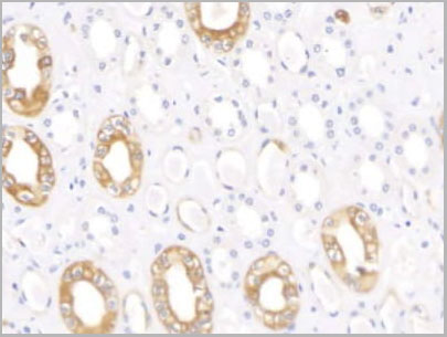 product-image-AAA21226_IHC4.jpg