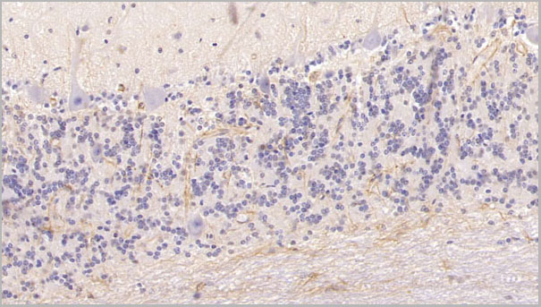 product-image-AAA21226_IHC5.jpg