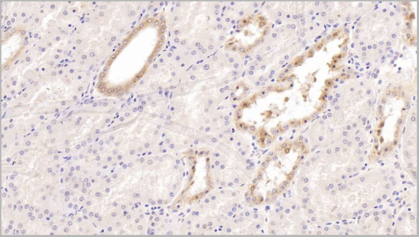 product-image-AAA21226_IHC7.jpg
