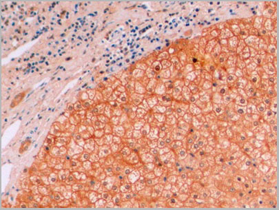 product-image-AAA21227_IHC2.jpg