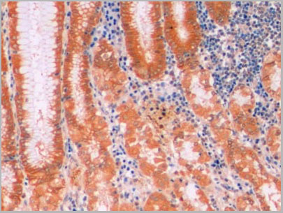product-image-AAA21227_IHC4.jpg