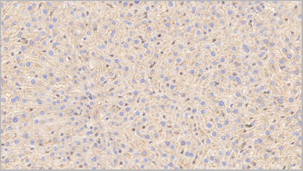 product-image-AAA21228_IHC3.jpg