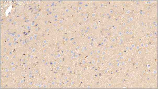 product-image-AAA21228_IHC4.jpg