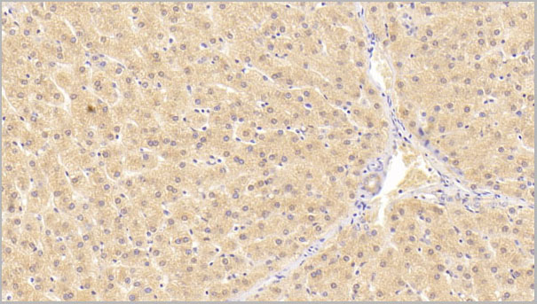 product-image-AAA21229_IHC2.jpg