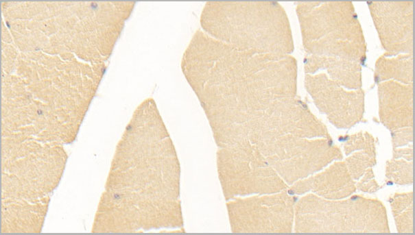 product-image-AAA21229_IHC3.jpg