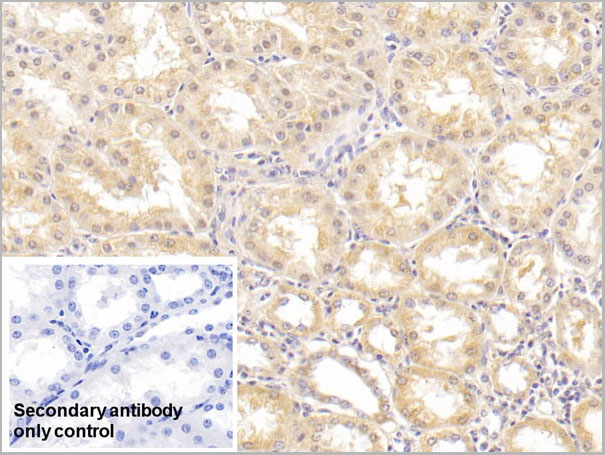 product-image-AAA21229_IHC5.jpg