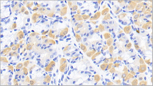 product-image-AAA21230_IHC.jpg