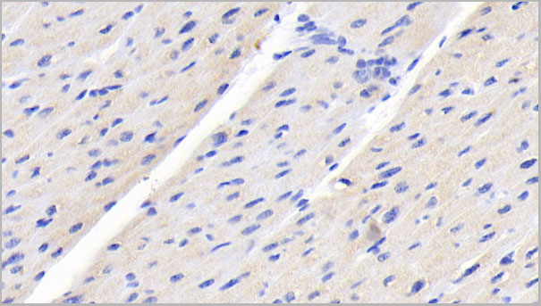 product-image-AAA21230_IHC2.jpg
