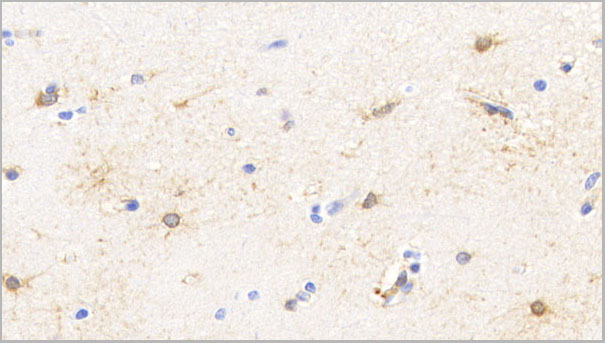 product-image-AAA21230_IHC3.jpg