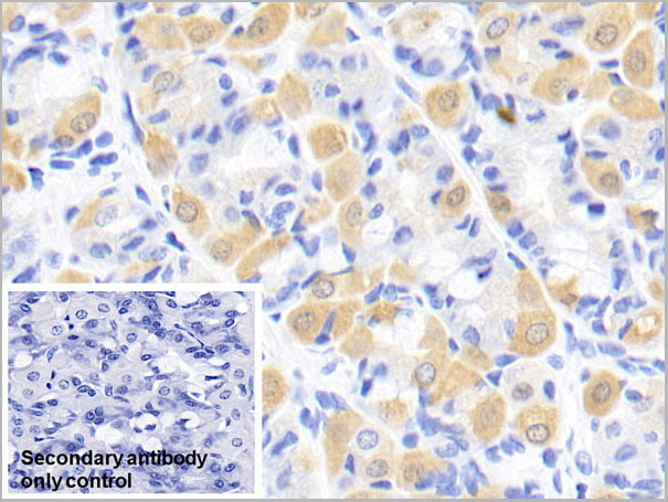 product-image-AAA21230_IHC6.jpg