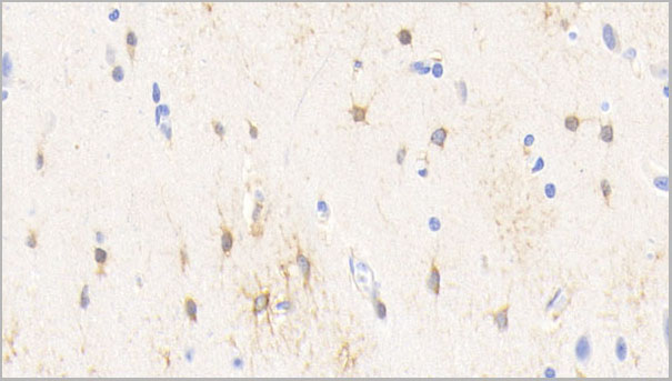 product-image-AAA21231_IHC2.jpg