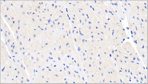 product-image-AAA21231_IHC3.jpg